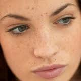 Thực phẩm trị nám da sau sinh an toàn