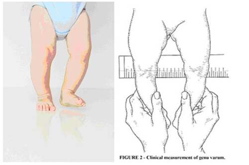 Độ tuổi nào mẹ nên bắt đầu sử dụng xe tập đi cho bé