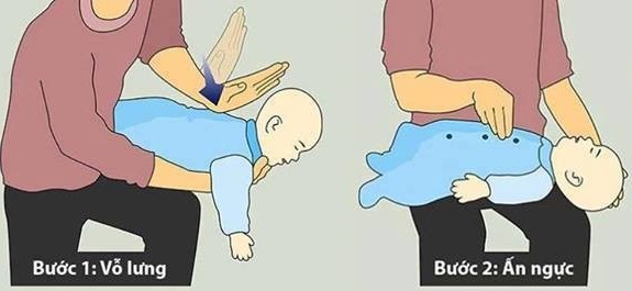 Cách sơ cứu trẻ nhỏ khi gặp nạn – Mẹ cần biết Cách sơ cứu cho trẻ nhỏ khi gặp nạn - Mẹ cần biết