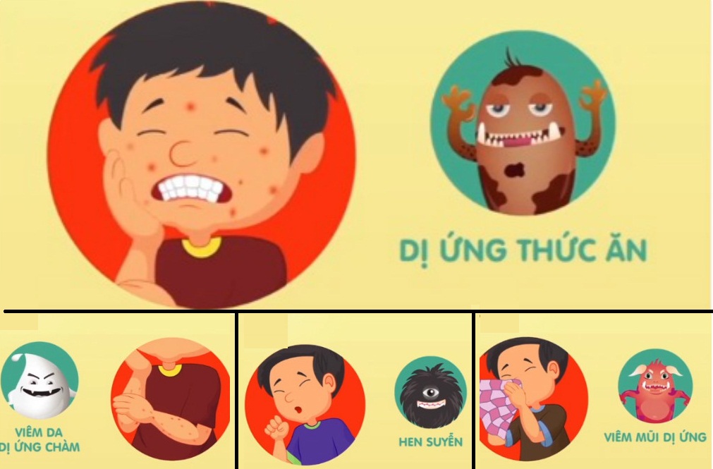 4 loại dị ứng phổ biến thường gặp ở trẻ nhỏ 4 loại dị ứng phổ biến ở trẻ nhỏ