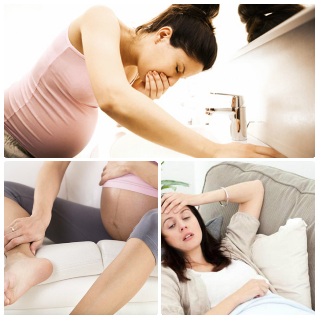 Mách mẹ bầu cách phòng ngừa, điều trị nhiễm độc thai nghén Biểu hiện của nhiễm độc thai nghén