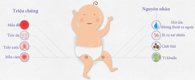 Đóng bỉm/tã Huggies cho trẻ sơ sinh cả ngày có sao không?