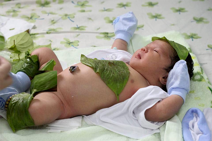 Tổng hợp 49 hiện tượng sinh lý ở trẻ và cách xử lý cho mẹ