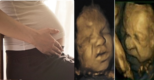 3 tư thế nằm khiến thai nhi NGỘT NGẠT, THIẾU OXY mẹ bầu cần tránh