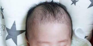 Bình sữa Upis 180ml Hàn Quốc dành cho bé từ sơ sinh khiến bé “mê tít”