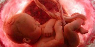 Rủi ro to lớn của nhau tiền đạo đối với mẹ bầu và con