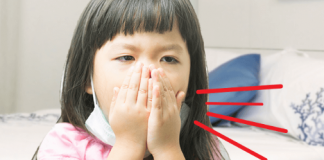 Những sai lầm khi ba mẹ tự điều trị ho cho con tại nhà