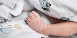 Giải đáp trẻ sơ sinh nằm điều hòa bị khô da có sao không?