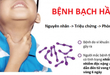 Bệnh bạch hầu là gì? Nguyên nhân và cách phòng ngừa cho trẻ nhỏ