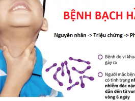 Bệnh bạch hầu là gì? Nguyên nhân và cách phòng ngừa cho trẻ nhỏ