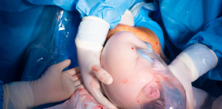 “Đẻ bọc điều” có ý nghĩa gì? Lời giải đáp khoa học và quan niệm dân gian