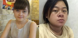 Cách giảm mũi to khi mang thai mẹ bầu nào cũng nên biết cach-giam-mui-to-khi-mang-thai