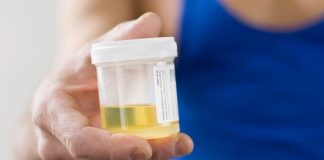 Nước tiểu khi có thai màu gì? Những điều mẹ nên biết