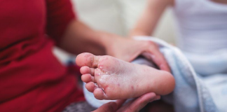 Giải đáp: Bé bị chân tay miệng có kiêng gió không?