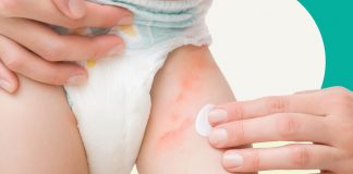 Bé bị hăm nên rửa nước gì? Cách chăm sóc da cho trẻ đúng cách