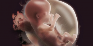 Đa ối là gì? Hiểu đúng để mẹ bầu phòng ngừa rủi ro kịp thời