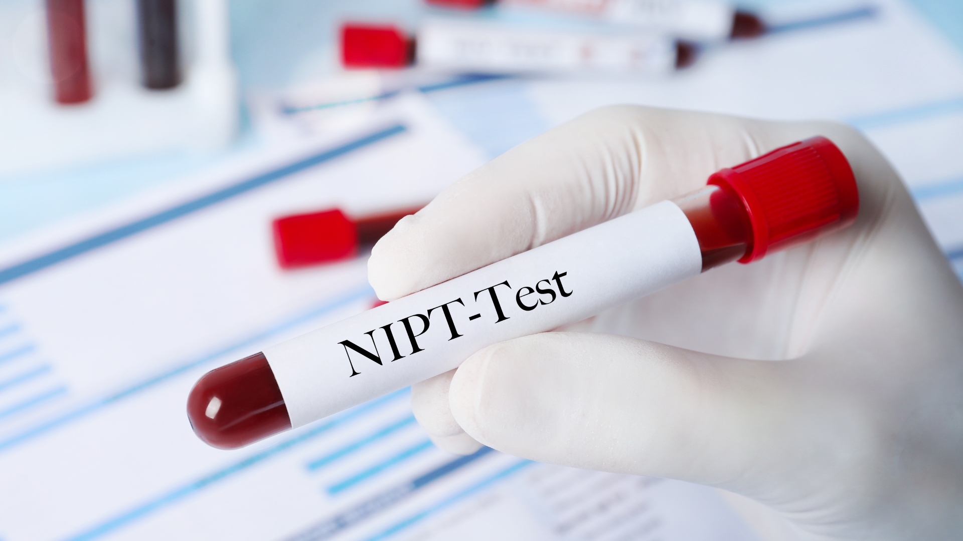 lam-nipt-o-tuan-thu-may-1