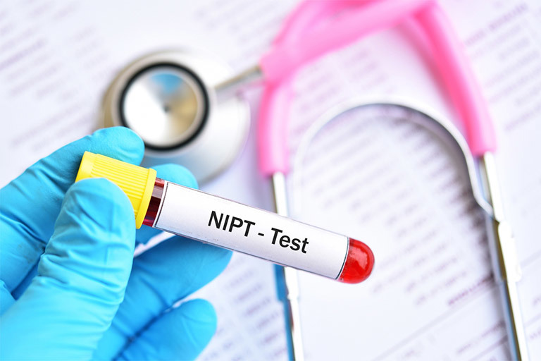 nipt-bao-lau-co-ket-qua-2