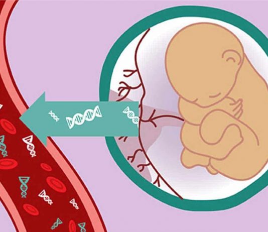 Làm xét nghiệm NIPT có biết trai hay gái không?