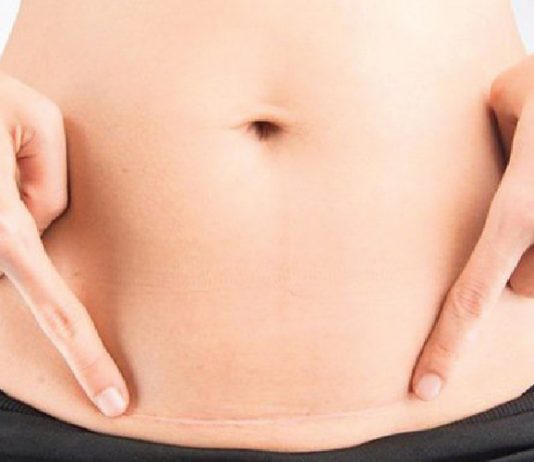 Chiếu tia Plasma có tác dụng gì? Có thật sự tốt như lời đồn?