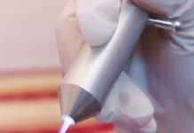 Tia plasma – Cứu tinh cho vết khâu tầng sinh môn sưng đau, nhiễm khuẩn?