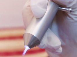 Tia plasma – Cứu tinh cho vết khâu tầng sinh môn sưng đau, nhiễm khuẩn?