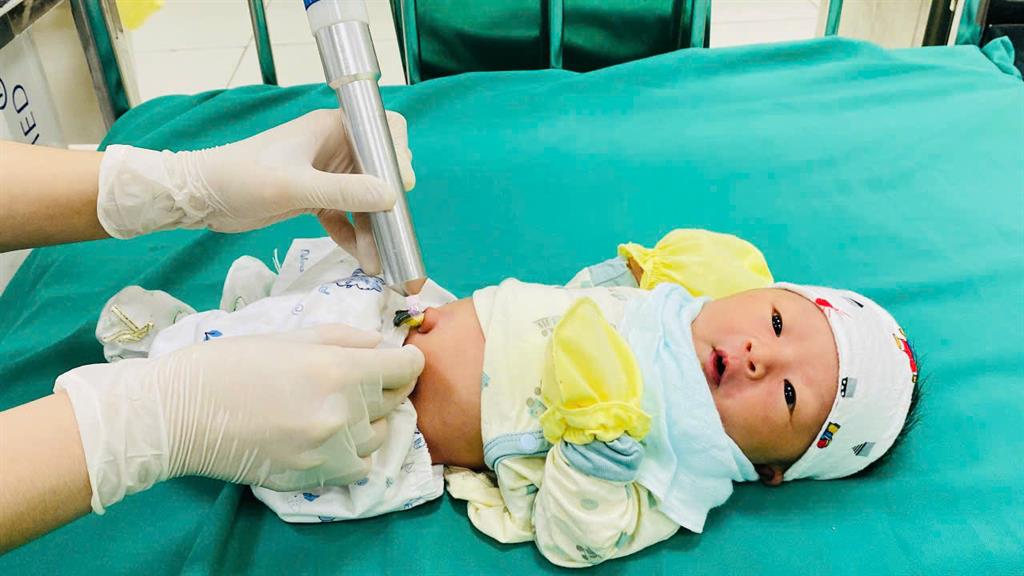 chiếu tia plasma cuống rốn
