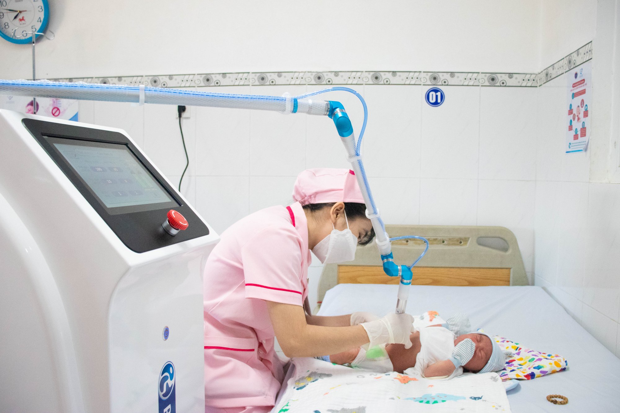 chiếu tia plasma cuống rốn