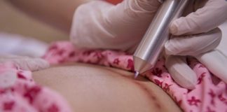 Giải mã chiếu tia plasma là gì và vì sao mẹ sau sinh nên biết