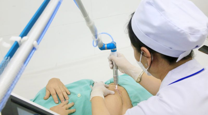 chiếu tia plasma nhiều có tốt không