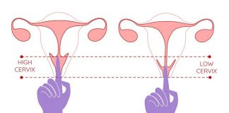 Cổ tử cung ngắn là như thế nào? Dấu hiệu & cách nhận biết