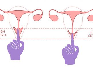 Cổ tử cung ngắn là như thế nào? Dấu hiệu & cách nhận biết