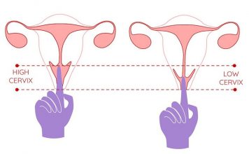 Cổ tử cung ngắn là như thế nào? Dấu hiệu & cách nhận biết