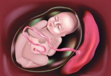 Nhau thai bám mặt trước là gì? Có nguy hiểm không? nhau-thai-bam-mat-truoc-1