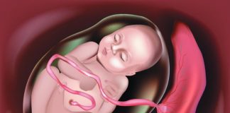 Nhau thai bám mặt trước là gì? Có nguy hiểm không? nhau-thai-bam-mat-truoc-1