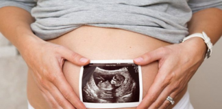 Nhau thai bám mặt trước có sao không? Cần lưu ý gì? nhau-thai-bam-mat-truoc-co-sao-khong