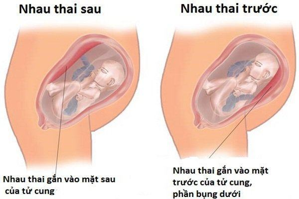 nhau-thai-bam-mat-truoc-hay-sau-tot-1