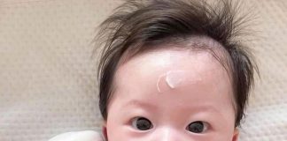 Kem dưỡng Goongbe có corticoid không? Giải đáp chi tiết cho mẹ bỉm yên tâm