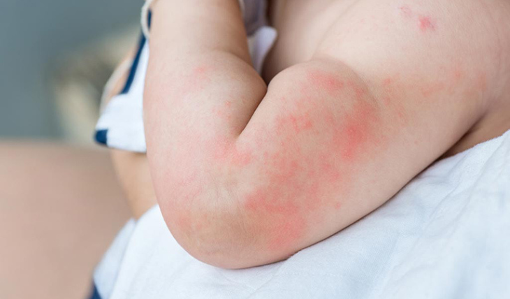 bao-ve-da-be-dip-tet-3