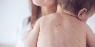 Sốt xuất huyết ở trẻ sơ sinh: Dấu hiệu cha mẹ dễ bỏ sót và cách bảo vệ con sot-xuat-huyet-o-tre-so-sinh-dau-hieu-cha-me-de-bo-qua-1