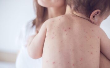 Sốt xuất huyết ở trẻ sơ sinh: Dấu hiệu cha mẹ dễ bỏ sót và cách bảo vệ con sot-xuat-huyet-o-tre-so-sinh-dau-hieu-cha-me-de-bo-qua-1