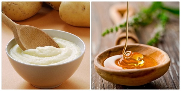 11 mẹo trị mụn tự nhiên cực hiệu quả cho mẹ bầu xinh đẹp suốt thai kì