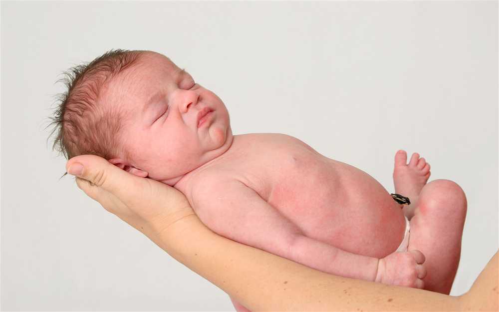 Chăm sóc bé sơ sinh 1 tháng tuổi: Vệ sinh rốn cho bé thế nào?