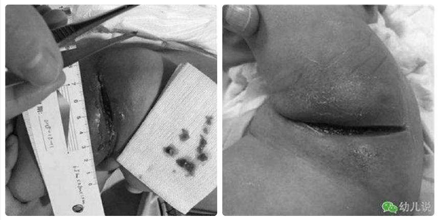 Mẹ lười tắm cho con vào mùa đông và những tác hại khôn lường gây ra Mẹ lười tắm cho con vào mùa đông và tác hại gây ra